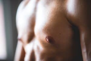 Adult Gynecomastia Surgery San Antonio